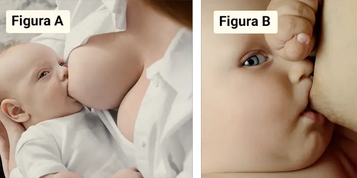 Bebês mamando errado no peito